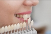 Fix Your Smile In No Time With Porcelain Veneers